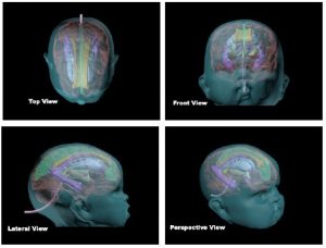 Advanced Newborn Head Phantom for Ultrasonography Training - Image 2