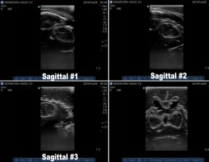 Advanced Newborn Head Phantom for Ultrasonography Training - Image 3