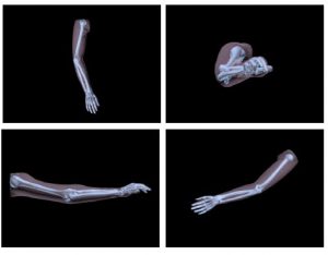 Adult Arm Phantom for X-Ray Training - Image 2