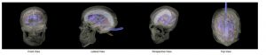 Skull Phantom with the Brain for Imagining of MRI CT X-RAY AND Ultrasounds - Image 3