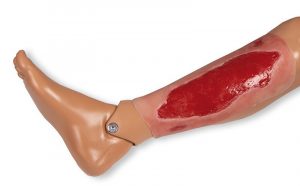 Model Arterial Leg Ulcer Granulation Phase Large Size - Image 2