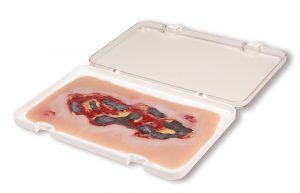 Model Arterial Leg Ulcer Exudation Phase Large Size - Image 2