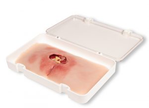 Decubitus Ulcer Model in the Sacrum Area Cleaned - Image 2