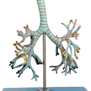 Bronchial Tree Model