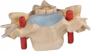 Cervical Vertebra with Spinal Cord