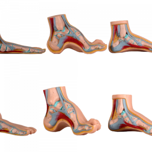 Normal Flat Arched Foot