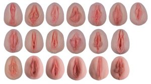 Vulva Types with Comparative Analysis