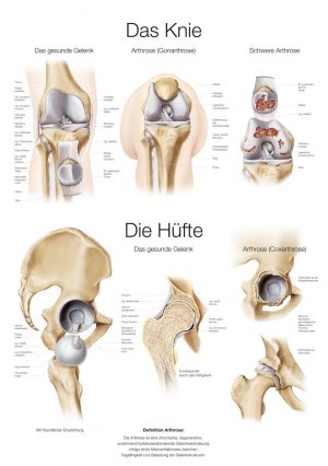 Anatomy Chart knee Hip