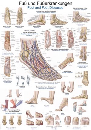 Anatomy Board Foot and its Diseases 50x70cm