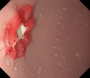 EGD EsophagoGastroDuodenoscopy Simulator - Image 5