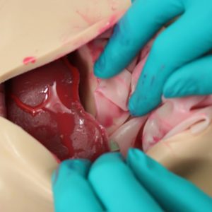Pediatric Phantom for General Surgery - Image 4
