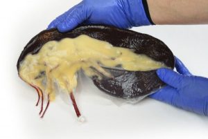 Canine Spleen w/Pathologies Vascularized - Image 3