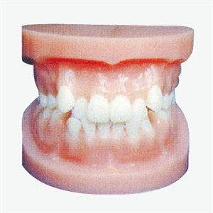Orthodontic Model of the Jaw