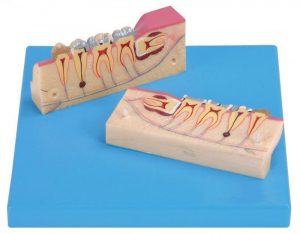 Dissected Model of Teeth Tissue