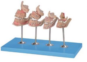 Teeth Development