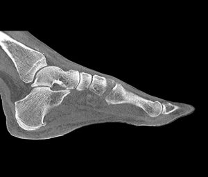 Phantom Foot for CT  X-ray and Radiotherapy - Image 2