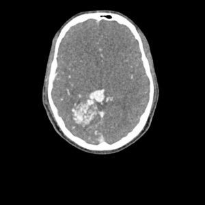 Head and Neck Phantom for CT  X-Ray and Radiation Therapy - Image 2