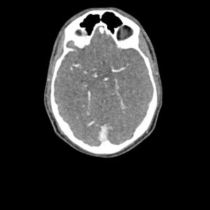 Head and Neck Phantom for CT  X-Ray and Radiation Therapy - Image 3