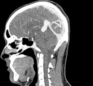 Head and Neck Phantom for CT  X-Ray and Radiation Therapy - Image 4