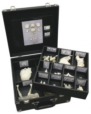 Adult Skull Model Bones Disassembled in a Suitcase