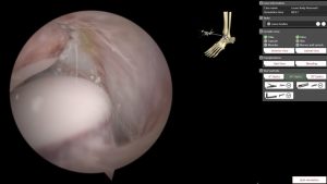 ArthroS™ High fidelity Simulator for Learning Ankle Joint Arthroscopy - Image 2