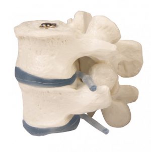 Model of the Two Lumbar Vertebrae