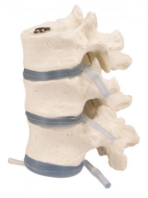 Model of the Three Thoracic Vertebrae