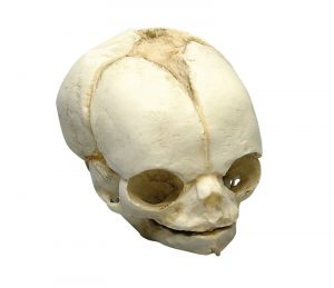 Fetal Skull Model 21 ½ Weeks