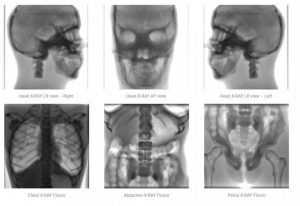 Wholehuman Body Phantom for X-Ray CT and MRI Training Adult - Image 4