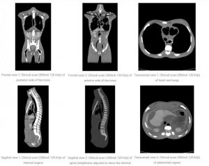 Wholehuman Body Phantom for X-Ray CT and MRI Training Adult - Image 5