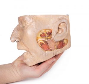 Parotid Gland and Facial Nerve Dissection - Image 5