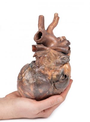 Heart - Image 5