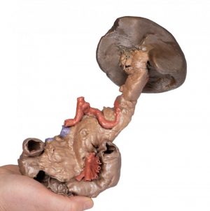 Spleen and Pancreas - Image 4