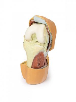 Flexed knee Joint Deep Dissection - Image 6