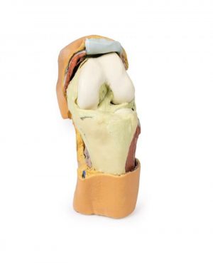 Flexed knee Joint Deep Dissection - Image 7