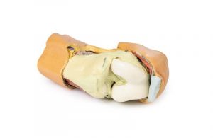 Flexed knee Joint Deep Dissection - Image 3