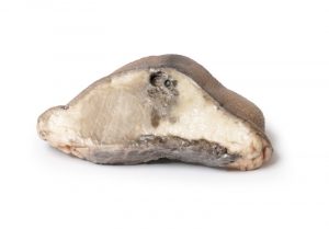 Carcinoma of Breast - Image 2