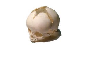 Newborn Skull