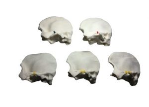 Temporal Bone Phantom