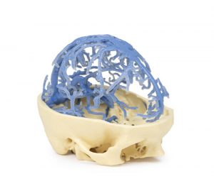 Cranial Venous Circulation - Image 3
