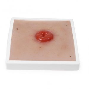 Wound Moulage Colostoma incl stand