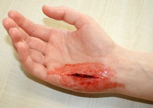 EZ Wounds Professional Wound Simulation Set - Image 10