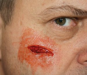 EZ Wounds Professional Wound Simulation Set - Image 2
