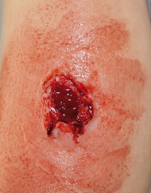 EZ Wounds Professional Wound Simulation Set - Image 4