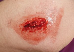 EZ Wounds Professional Wound Simulation Set - Image 5