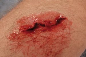 EZ Wounds Professional Wound Simulation Set - Image 9